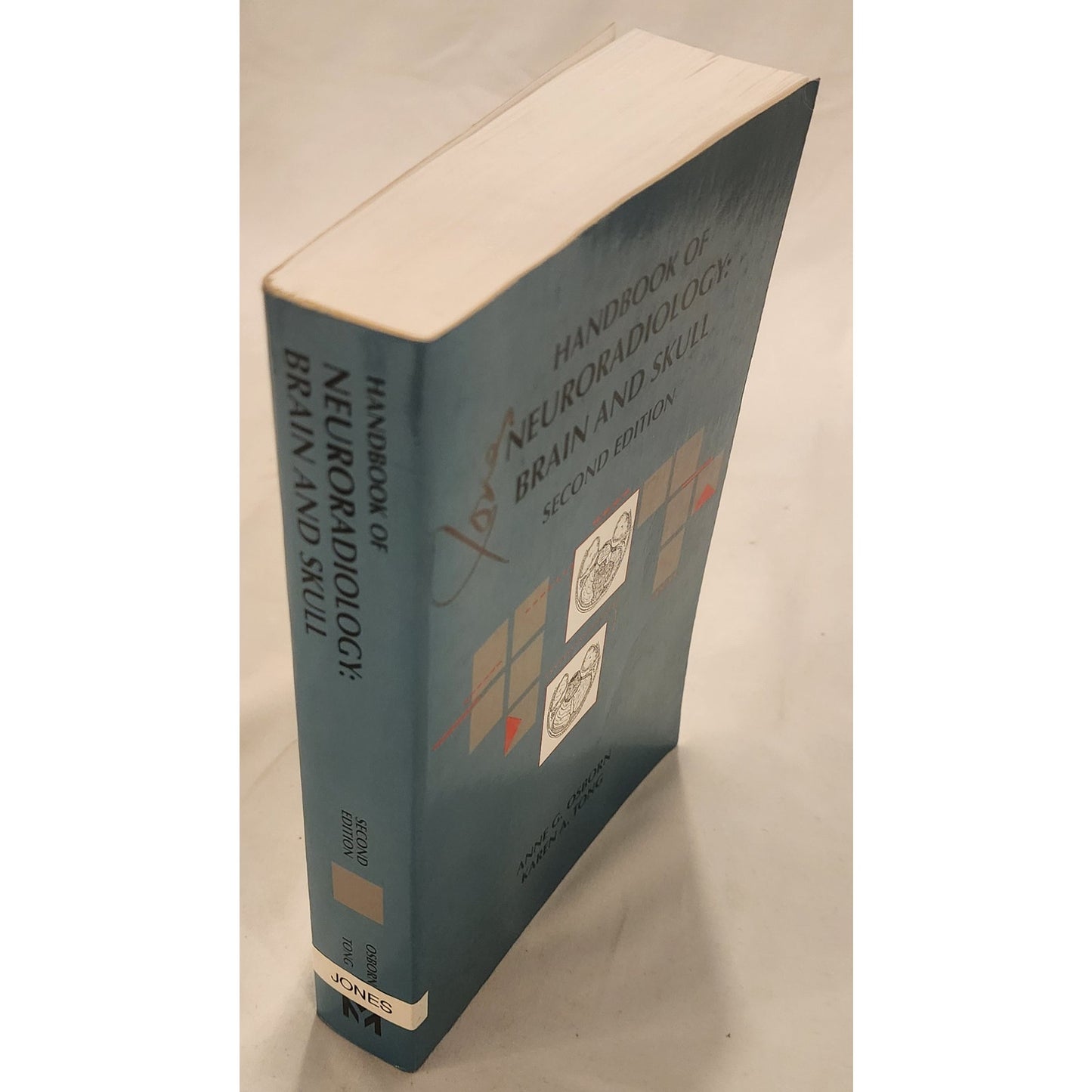 Handbook of Neuroradiology: Brain and Skull (Second Edition, 1996