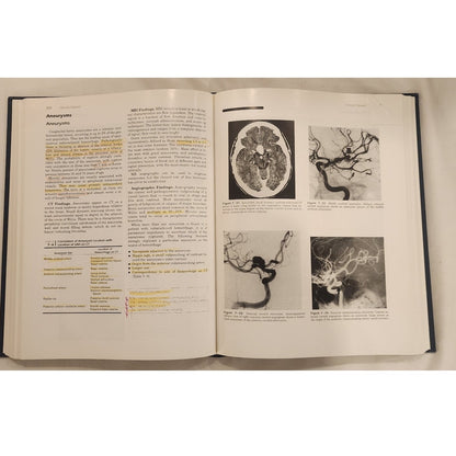 Atlas of Neuroradiology – Willing – Highlighted/Writing – Good Reading Copy