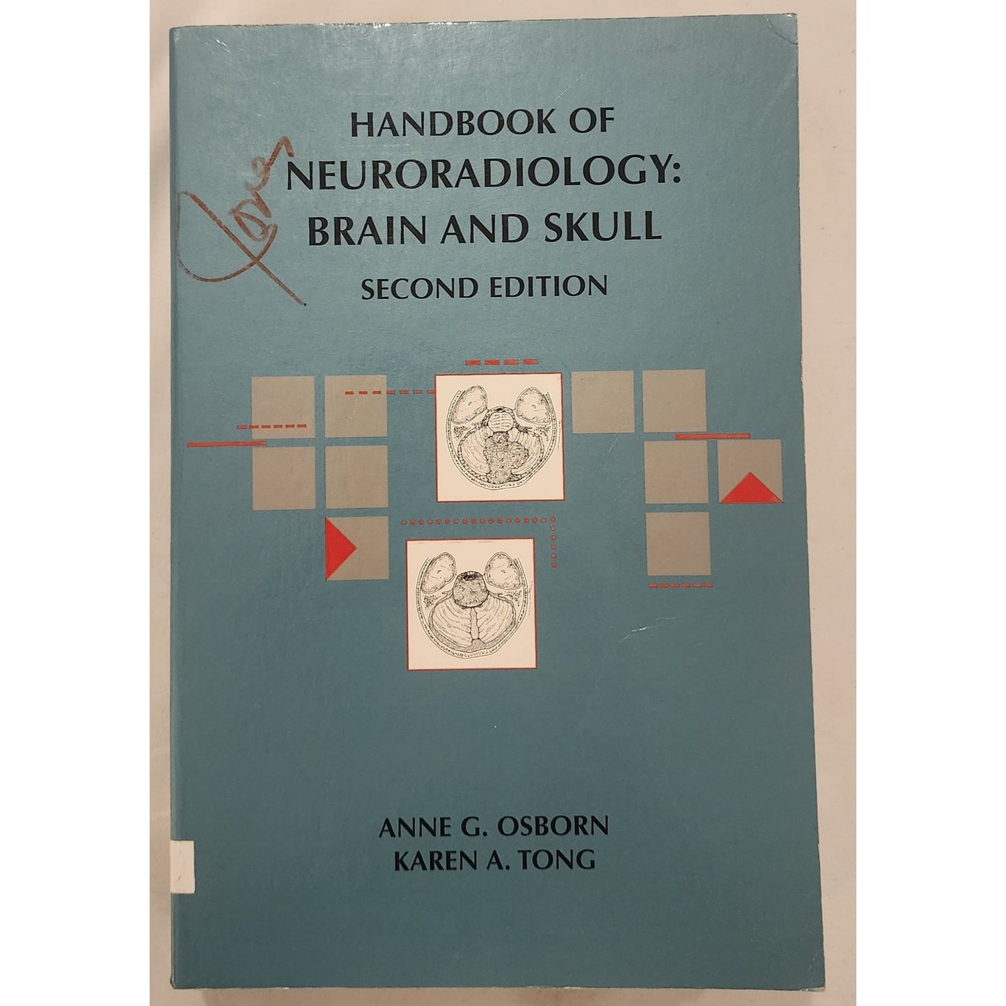 Handbook of Neuroradiology: Brain and Skull (Second Edition, 1996